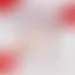 Hematopoetik Kök Hücre Nakli Öncesi Şelasyon Tedavisinin Yeri