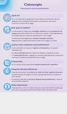 Cistoscopia