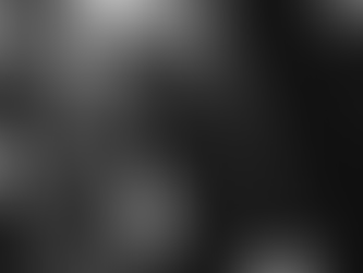 When Can You Return to Sport After a Lumbar Stress Fracture?