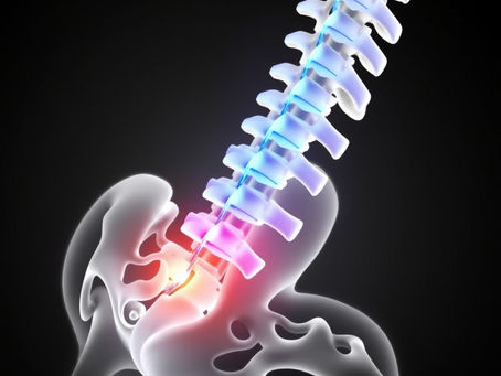 Can You Train With a Lumbar Stress Fracture?