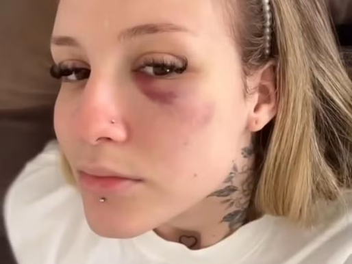 Jogador Caio Paulista, do Palmeiras, é acusado de agressão pela ex-esposa