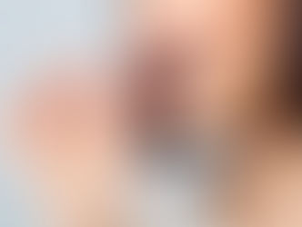 認識容易造成齲齒的食物