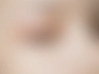 Different Types of Moisturizers: Finding the Right Hydration for Your Skin Type