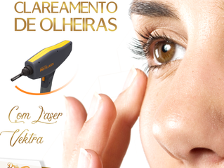 Clareamento de olheiras com Laser Vektra