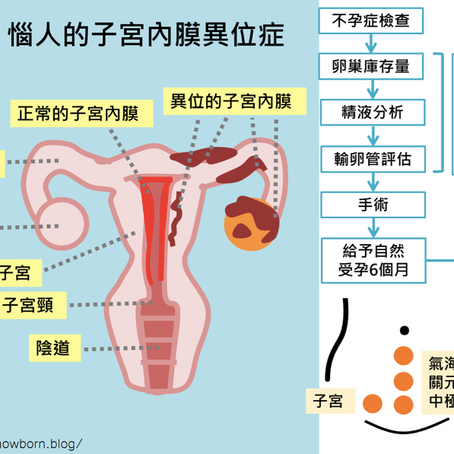 惱人的子宮內膜異位症