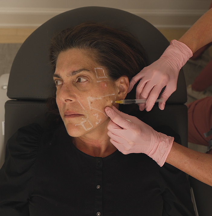 Sculptra.jpg