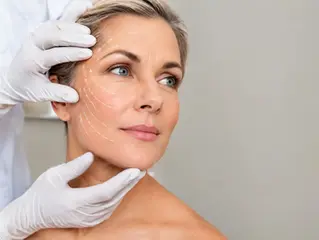 Como funciona o lifting facial cirúrgico?