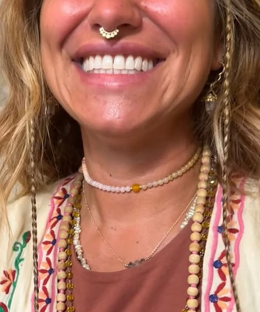 Thumbnail: Tiger Skin