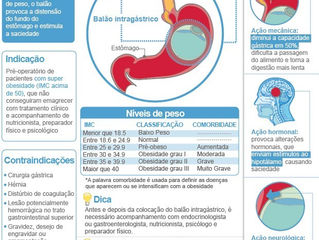Balão intragástrico reduz apetite e só é eficiente com mudança de hábitos