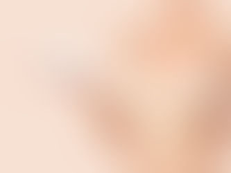 A Comprehensive Guide to Breast Augmentation Surgery