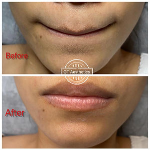 Before And After Enzyme Cleanser.jpeg