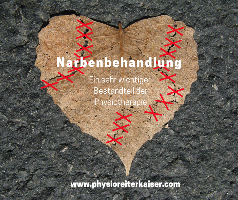 Weißt Du eigentlich, dass man in der Physiotherapie mit speziellen manuellen Techniken, Lymphdrainage und Kinesio-Taping Deine Narbe hervorragend unterstützen kann?  Dies alles kann die Beweglichkeit und Heilung stark verbessern, Schmerzen lindern und den Lymphabfluss ankurbeln und Du kannst selbst auch sehr viel dafür tun!