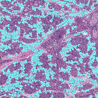 CellPose_Adipocyte_Example.jpg