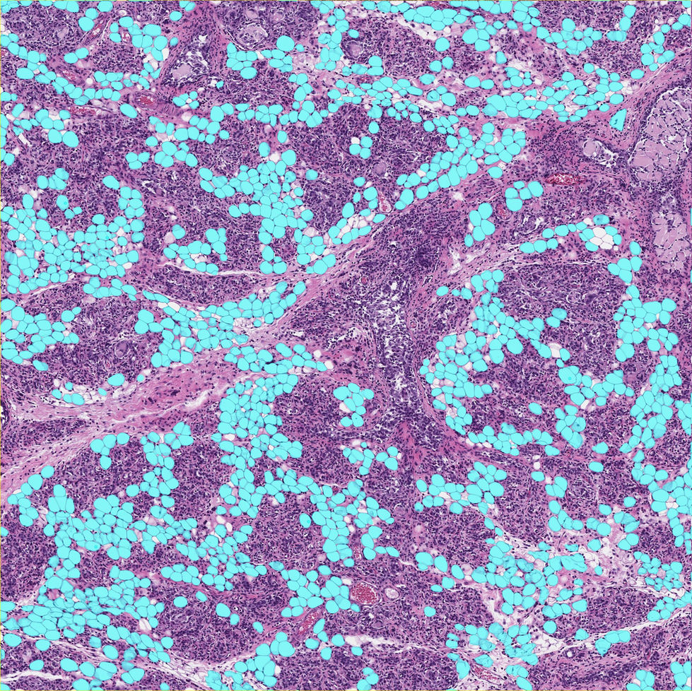 CellPose_Adipocyte_Example
