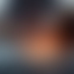 Understanding Sports Injuries and How They Affect Your Body