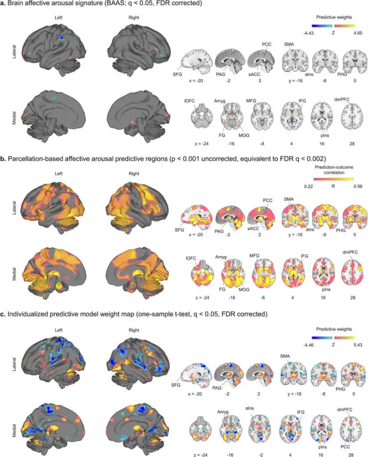 El modelo BAAS identifica un patrón distribuido en varias regiones cerebrales —como la amígdala, la ínsula y la corteza prefrontal— que predice con fiabilidad la intensidad del arousal emocional. Fuente: Nature Communications.