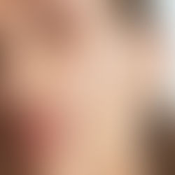 Rutina De La Farmacia Para Invierno