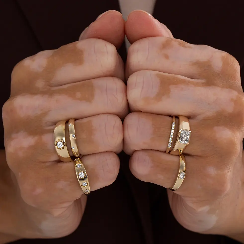 Thumbnail: Solitaire Pinky Ring