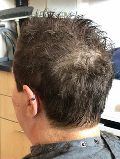 Back view of Lynn’s neat, short haircut
