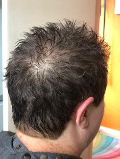 Back view of Lynn’s hair after her short cut