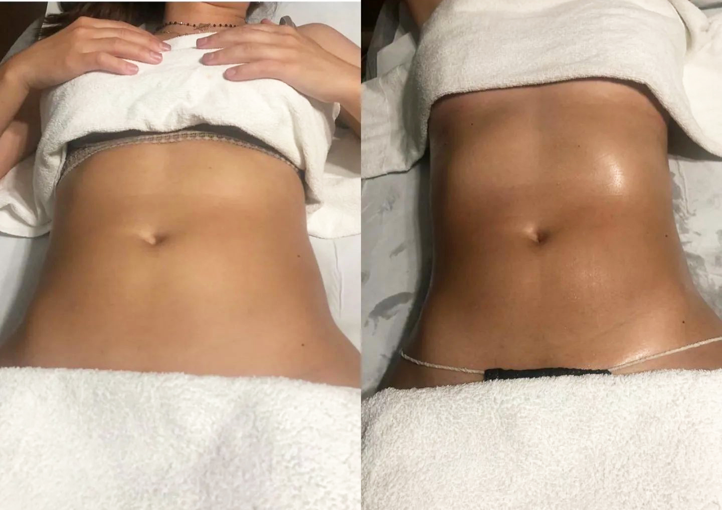 Massage abdominal tension ventrale.webp