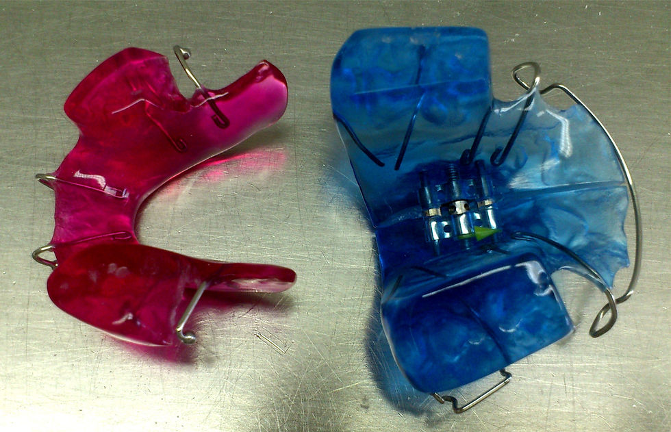 twin-block rose bleu solutions ortho