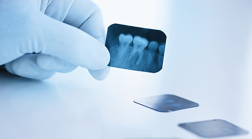 radio chez le dentiste