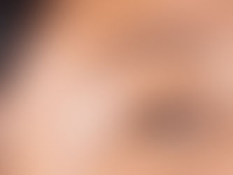 Oily Skin, Balanced Glow: Your Guide to Shine-Free Radiance
