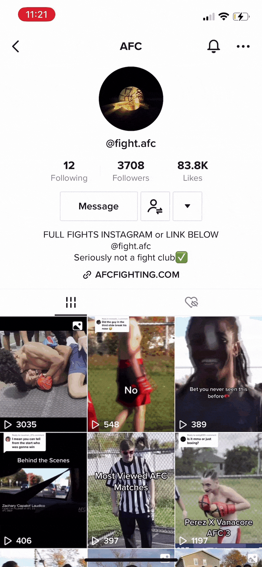 zxgxcgzxcgzx (1).gif