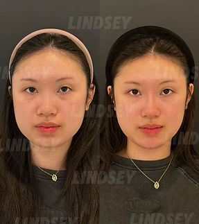 Boston Facial Balancing.jpg
