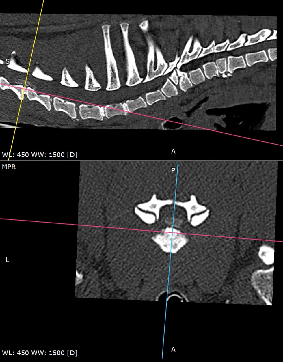 Rƶntgenfoto nekhernia en onderrug