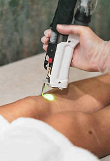 Laser Hair Removal