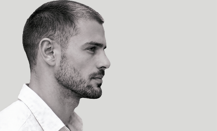 Man with scalp micorpigmentation for patchy hair