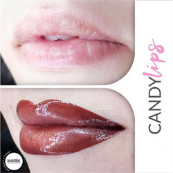 Μόνιμο Μακιγιάζ Χελιών | Dermacraft