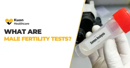 What Are Male Fertility Tests?