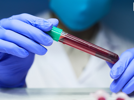 Know All About Anaemia: Symptoms, Causes, and Testing Options in the UK