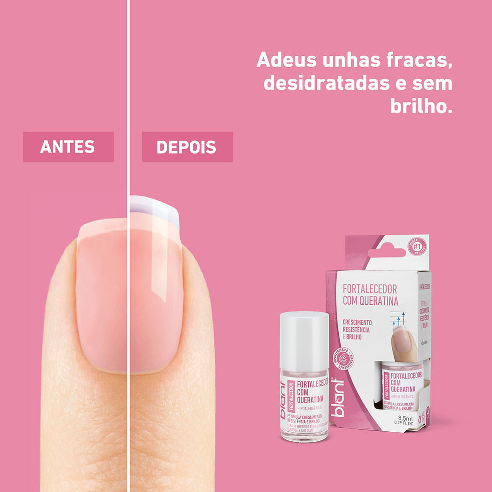 Unhas antes e depois: tratamento eficaz