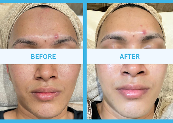 Skin Repair's Hydra Glow Facial Men (Before After).png