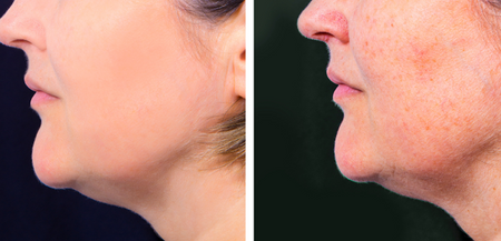 הכללים המנחים בטיפולים אסתטיים