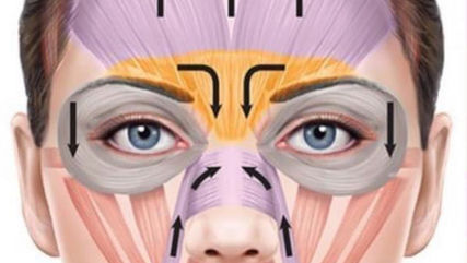 What is the Botox brow lift?