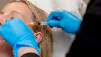 What is PRF, and why is it gaining popularity as a regenerative treatment