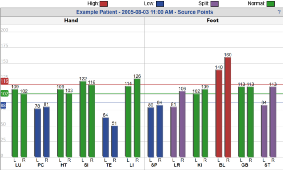 Qi Instruments Graph Introducing AcuGraph! See your Qi flow!