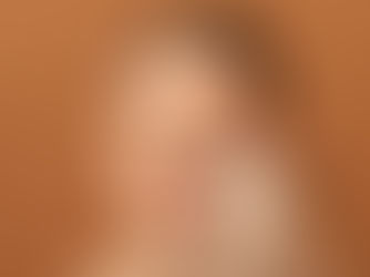 Does Rhinoplasty Leave Visible Scars Behind?