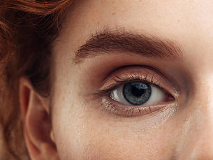Is Eyelid Surgery Right for Droopy Eyelids?