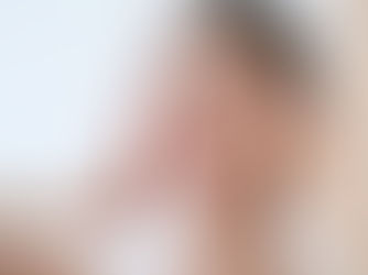 Is Liquid Rhinoplasty Right for Nose Reshaping?