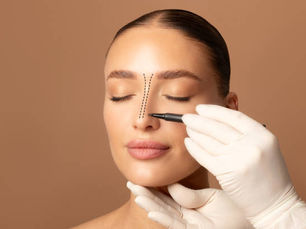 Can Rhinoplasty Fix a Broken Nose Permanently?