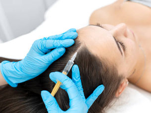 Is PRP Treatment Effective for Hair Loss?