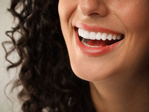 Can Teeth Whitening Remove Deep Stains Fast?