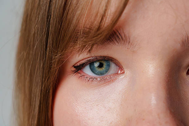 Why Choose Eyelid Surgery for Tired Eyes?