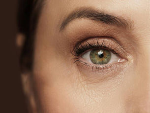 How Long Does Eye Bag Removal Really Last?